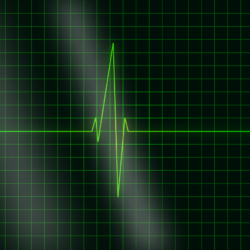 Proposition de loi relative au défibrillateur cardiaque electrocardiogram-36732_1280